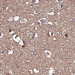 APOA1BP Antibody in Immunohistochemistry (IHC)
