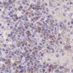 FAM168B Antibody in Immunohistochemistry (IHC)