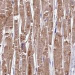 FAM168B Antibody in Immunohistochemistry (IHC)