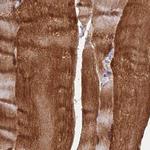 FAM168B Antibody in Immunohistochemistry (IHC)