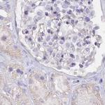 FAM168B Antibody in Immunohistochemistry (IHC)