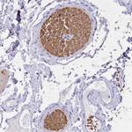 Hemoglobin alpha-1 Polyclonal Antibody