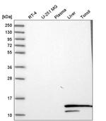 Hemoglobin alpha-1 Antibody in Western Blot (WB)