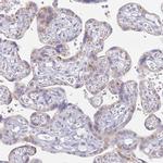 SLC38A9 Antibody in Immunohistochemistry (IHC)