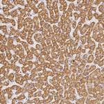 SLC38A9 Antibody in Immunohistochemistry (IHC)