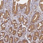 SLC38A9 Antibody in Immunohistochemistry (IHC)
