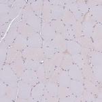 SLC38A9 Antibody in Immunohistochemistry (IHC)