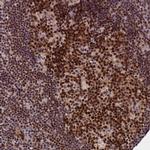 TCEA1 Antibody in Immunohistochemistry (Paraffin) (IHC (P))