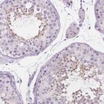 DCAF8L1 Polyclonal Antibody