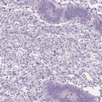 DCAF8L1 Antibody in Immunohistochemistry (IHC)