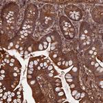 FCHSD1 Antibody in Immunohistochemistry (Paraffin) (IHC (P))