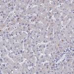 CHST5 Antibody in Immunohistochemistry (IHC)