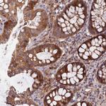 FAM151B Antibody in Immunohistochemistry (Paraffin) (IHC (P))