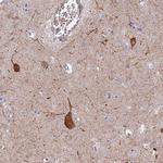 RHBDL2 Polyclonal Antibody