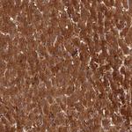 ISPD Polyclonal Antibody