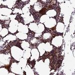 CCDC183 Polyclonal Antibody