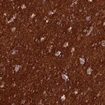 ST8SIA5 Polyclonal Antibody