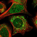 ANR52 Polyclonal Antibody