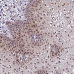 ANR52 Antibody in Immunohistochemistry (Paraffin) (IHC (P))
