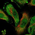 ZNF436 Polyclonal Antibody