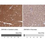 ZNF436 Antibody in Immunohistochemistry (IHC)
