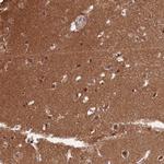 ZNF436 Antibody in Immunohistochemistry (IHC)
