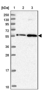 ZNF436 Antibody in Western Blot (WB)