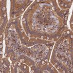 TRIM40 Polyclonal Antibody