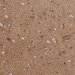 LRRN3 Polyclonal Antibody