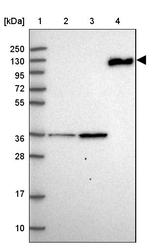 Complement C6 Antibody in Western Blot (WB)