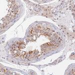 VSTM2L Antibody in Immunohistochemistry (Paraffin) (IHC (P))