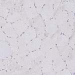 VSTM2L Antibody in Immunohistochemistry (Paraffin) (IHC (P))