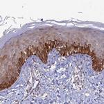 FASTKD5 Polyclonal Antibody