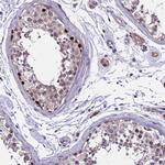TRIML2 Antibody in Immunohistochemistry (Paraffin) (IHC (P))