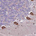 CNO Antibody in Immunohistochemistry (Paraffin) (IHC (P))