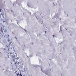 SRSF7 Antibody in Immunohistochemistry (IHC)