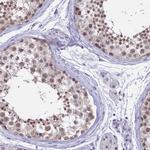 SRSF7 Antibody in Immunohistochemistry (IHC)