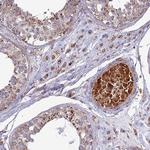 SLC35F4 Antibody in Immunohistochemistry (Paraffin) (IHC (P))