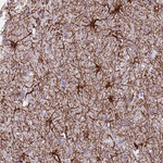 TAS2R38 Polyclonal Antibody