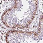 TAS2R38 Antibody in Immunohistochemistry (Paraffin) (IHC (P))