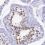 KCNK17 Polyclonal Antibody