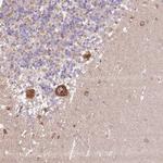 PPME1 Antibody in Immunohistochemistry (Paraffin) (IHC (P))