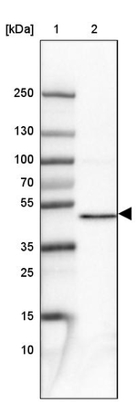 PPME1 Antibody in Western Blot (WB)
