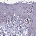 PCED1B Antibody in Immunohistochemistry (IHC)