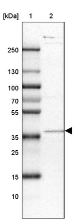 ACAD8 Antibody in Western Blot (WB)