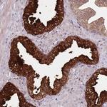 VWCE Antibody in Immunohistochemistry (Paraffin) (IHC (P))
