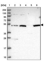 VWCE Antibody in Western Blot (WB)