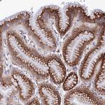 GCP6 Polyclonal Antibody