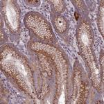 SPRYD7 Antibody in Immunohistochemistry (IHC)