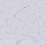 SCP3 Antibody in Immunohistochemistry (Paraffin) (IHC (P))